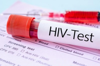 HIV-test.jpeg